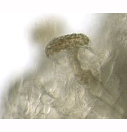 Phytomyza lappae larva,  anteriro spiracle,  lateral